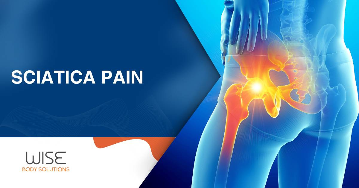 Sciatica Pain. Wise Body Solutions. 3D diagram of lower half of an individual with flaring sciatica pain.