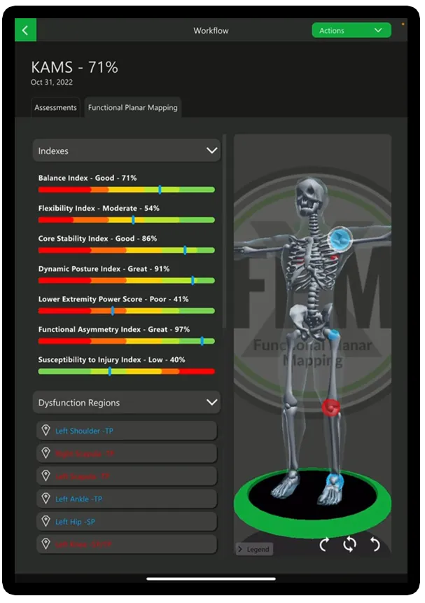 Sample Kinetisense FPM report showing KAMS scores and dysfunction body map